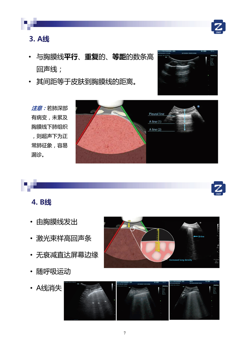 新冠肺超声实用手册(2)_35.jpg